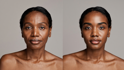 Narlea® Restore Serum