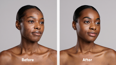 Narlea® Restore Serum