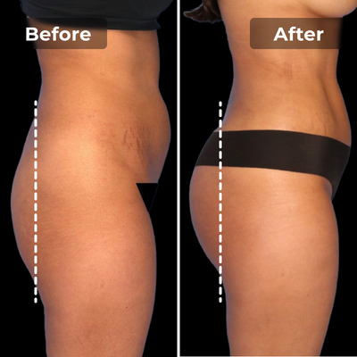 Narlea® Firm & Tone Shorts